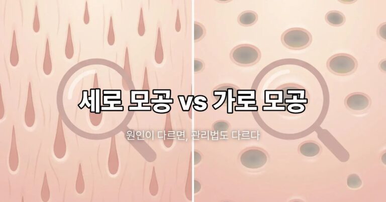 Comparison of vertical pores caused by skin elasticity loss and horizontal pores caused by excess sebum, skincare infographic